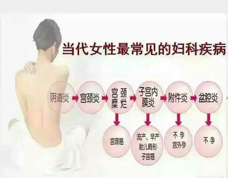 全国妇科医院排行榜前十名揭晓，女性健康守护的坚实后盾